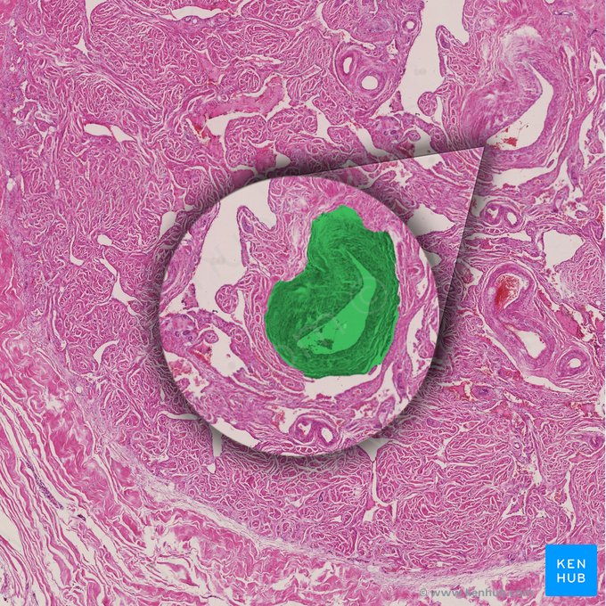 Helicine artery of penis (Arteria helicina penis); Image: 