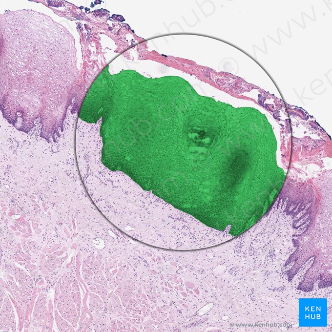 Mucosa (Tunica mucosa); Imagen: 