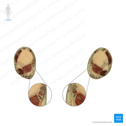 Posterior tibial artery (Arteria tibialis posterior); Image: National Library of Medicine
