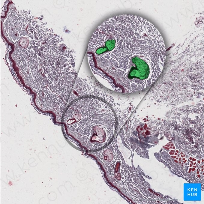 Glândulas sebáceas dos cílios; Imagem: 