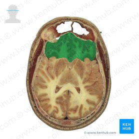 Frontal lobe (Lobus frontalis); Image: National Library of Medicine