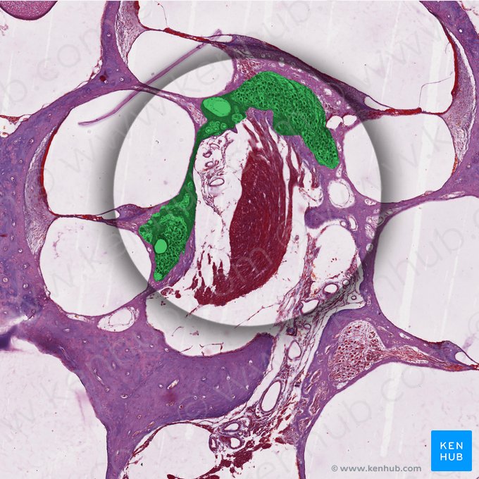 Ganglion cochleare (Schneckenganglion); Bild: 