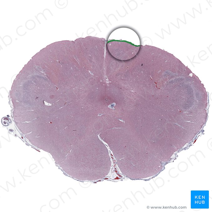 Fascículo grácil (Fasciculus gracilis); Imagen: 