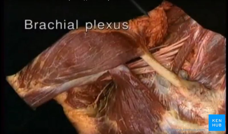 Acland's Video Atlas of Human Anatomy - Sample Dissection