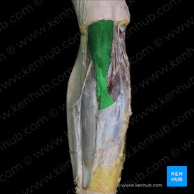 Musculus biceps brachii (Zweiköpfiger Oberarmmuskel); Bild: 