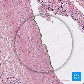 Endothelium of artery (Endothelium arteriae); Image: 