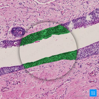 Epithelium stratificatum squamosum (Mehrschichtiges Plattenepithel); Bild: 