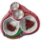 Sinus coronaire