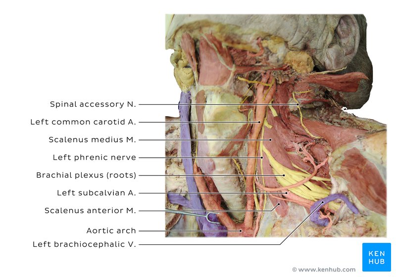 Roots of the brachial plexus - cadaveric image