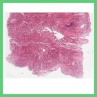 Glandula thyroidea - Histologie