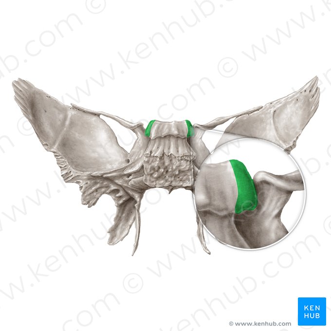 Processo clinoide posterior do osso esfenoide (Processus clinoideus posterior ossis sphenoidalis); Imagem: Samantha Zimmerman