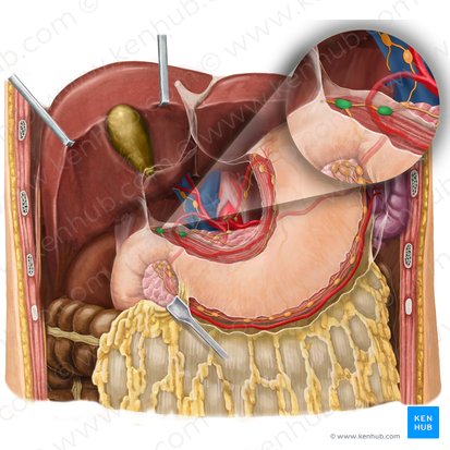 Nodi lymphoidei suprapylorici (Suprapylorische Lymphknoten); Bild: Begoña Rodriguez