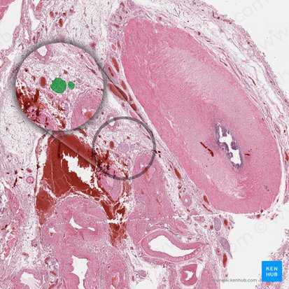 Genital branch of genitofemoral nerve (Ramus genitalis nervi genitofemoralis); Image: 