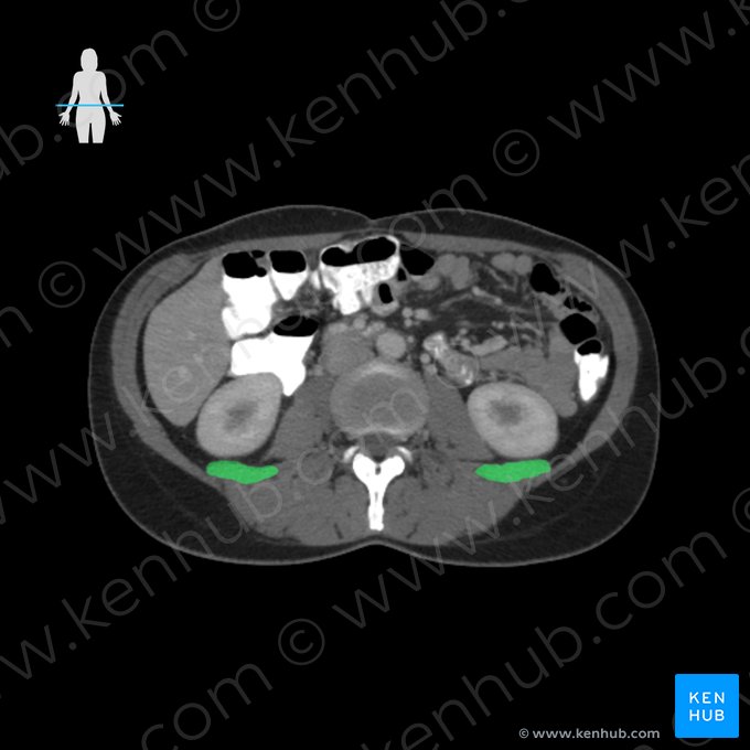 Musculus quadratus lumborum (Viereckiger Lendenmuskel); Bild: 