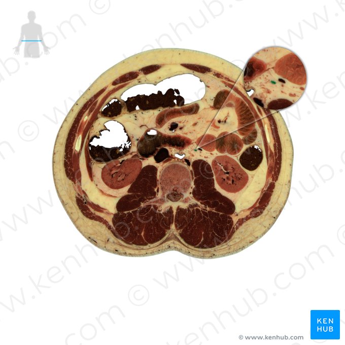 Arteria testicularis (Hodenarterie); Bild: National Library of Medicine