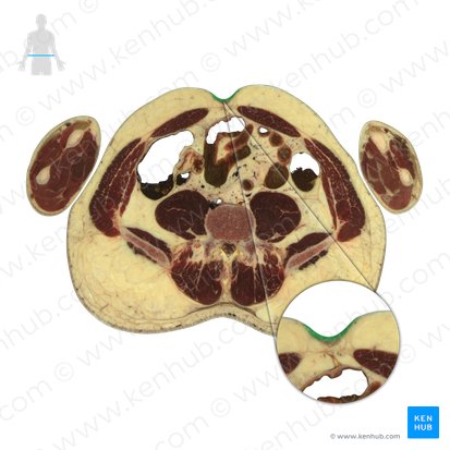 Umbilicus (Bauchnabel); Bild: National Library of Medicine