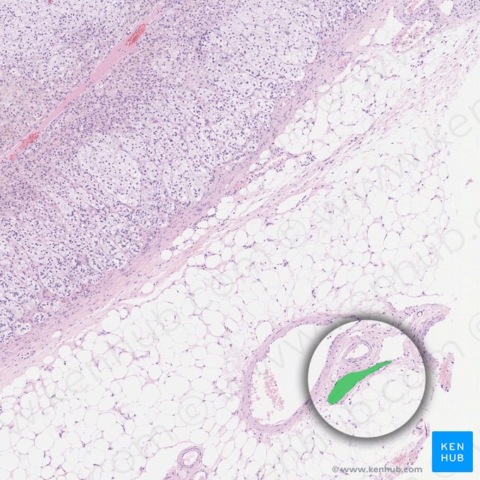 Lymphatic vessel (Vas lymphaticum); Image: 