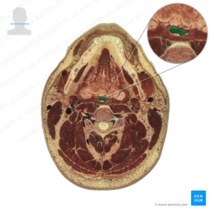 Pars oralis pharyngis (Mundrachen); Bild: National Library of Medicine