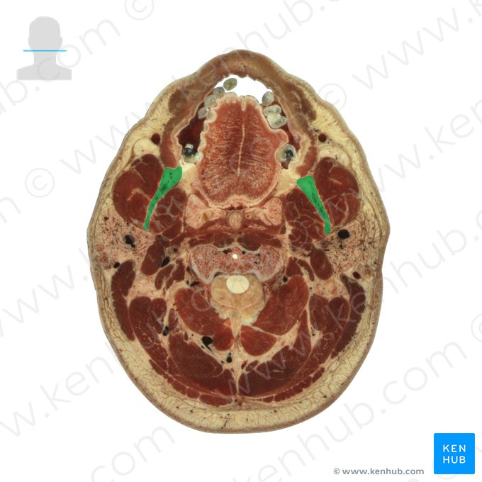 Ramus mandibulae (Aufsteigender Ast des Unterkieferknochens); Bild: National Library of Medicine