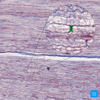 Myelin sheath gap (Nodus interruptionis myelini); Image: 