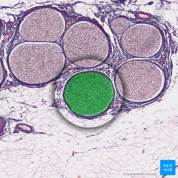 Nerve fascicle (Fasciculus nervi); Image: 