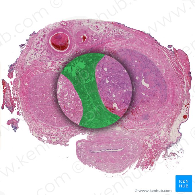 Median septum; Image: 