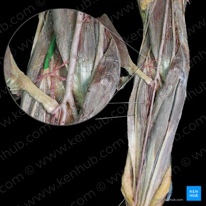 Radial nerve (Nervus radialis); Image: 