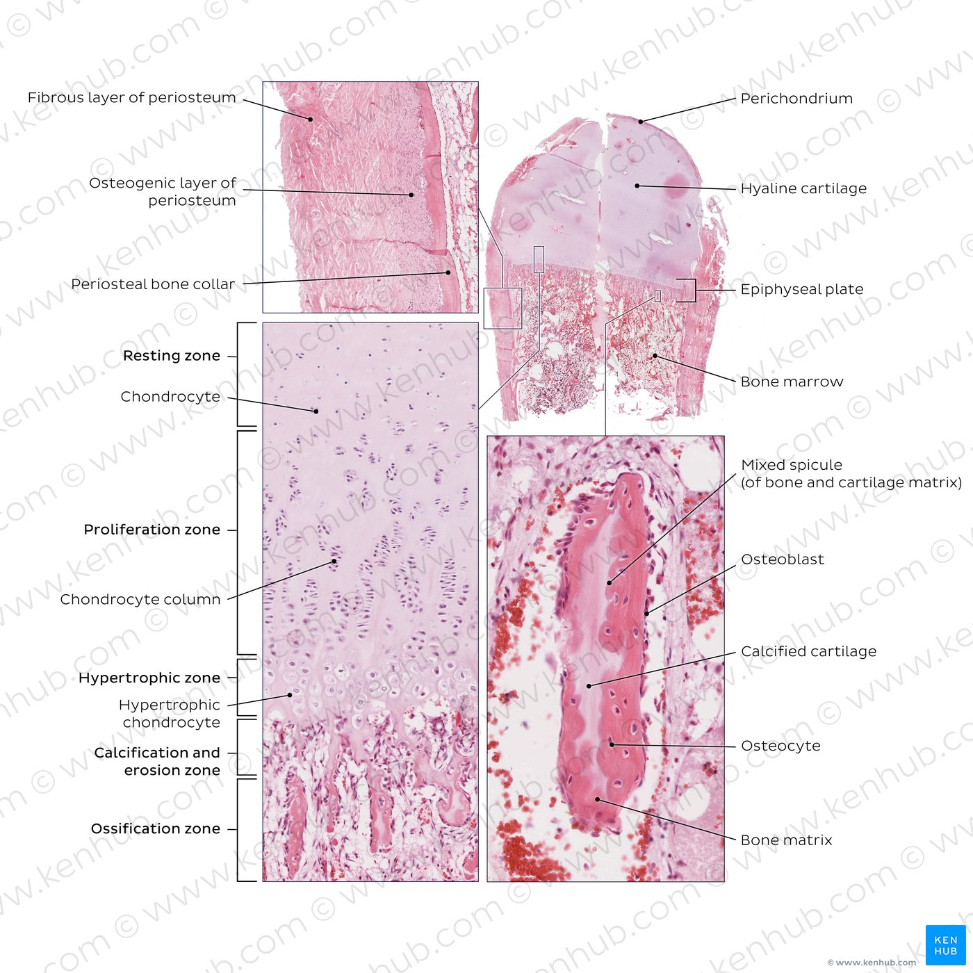 Endochondral and periosteal ossification. Stain: H&E.