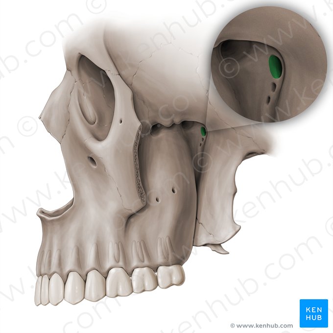 Forame redondo (Foramen rotundum); Imagem: Paul Kim