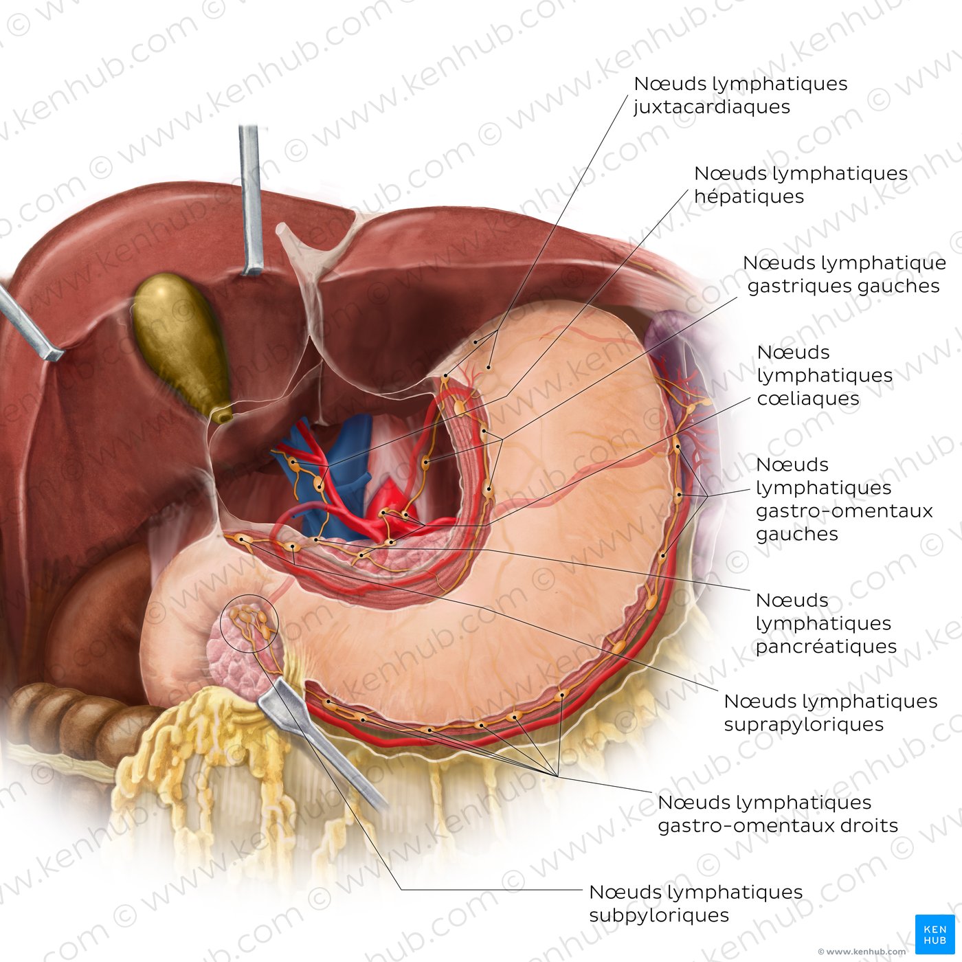 Nœuds et vaisseaux lymphatiques de l’estomac et du foie (vue antérieure)