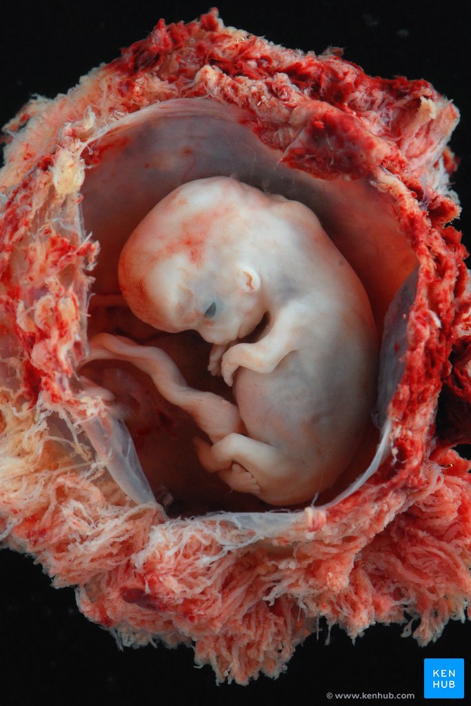 Embryo (10 weeks)