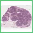 Lymphknoten - Histologie