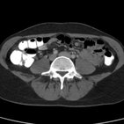 Normales Abdomen-CT