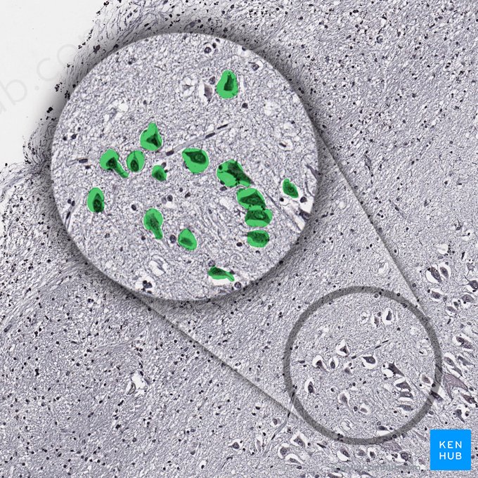 Célula priramidal del hipocampo; Imagen: 