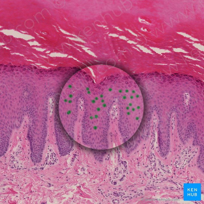 Spinous keratinocyte (Keratinocytus spinosus); Image: 