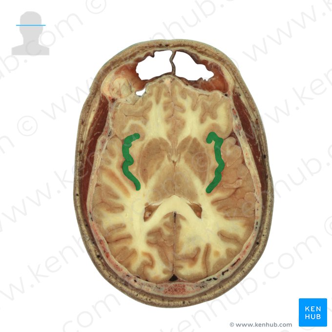 Lobo insular (Insula); Imagem: National Library of Medicine