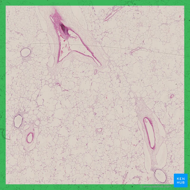 Lung - histological slide