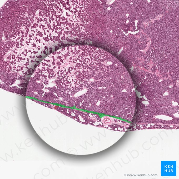 Septo de tecido conjuntivo (Septum textus connectivi); Imagem: 