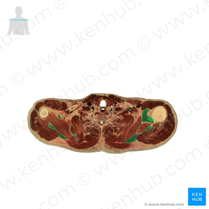 Escápula (Scapula); Imagem: National Library of Medicine