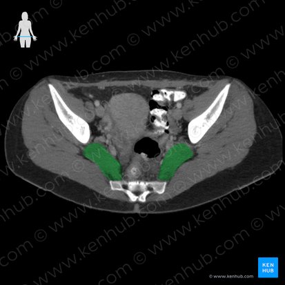 Musculus piriformis (Birnenförmiger Muskel); Bild: 