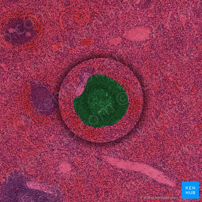 Nódulo linfático esplénico (Nodulus lymphoideus splenicus); Imagem: 