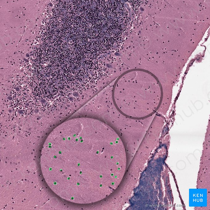 Células em cesto do cerebelo (Neuron cobiforme); Imagem: 
