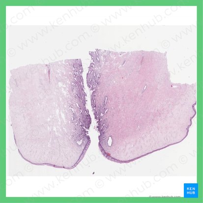 Cuello uterino (Cervix uteri); Imagen: 