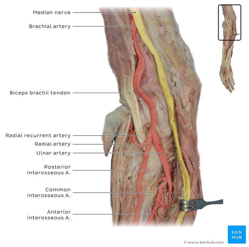 Nerves and vessels of the forearm in cadaver labeled