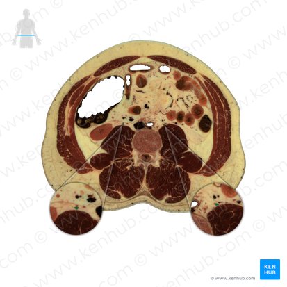 Ureter; Imagem: National Library of Medicine