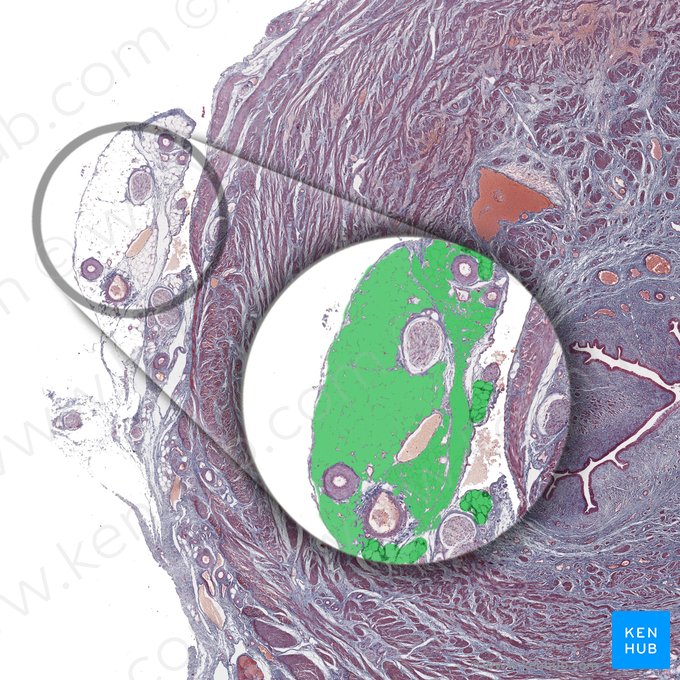 Gordura periuretral; Imagem: 