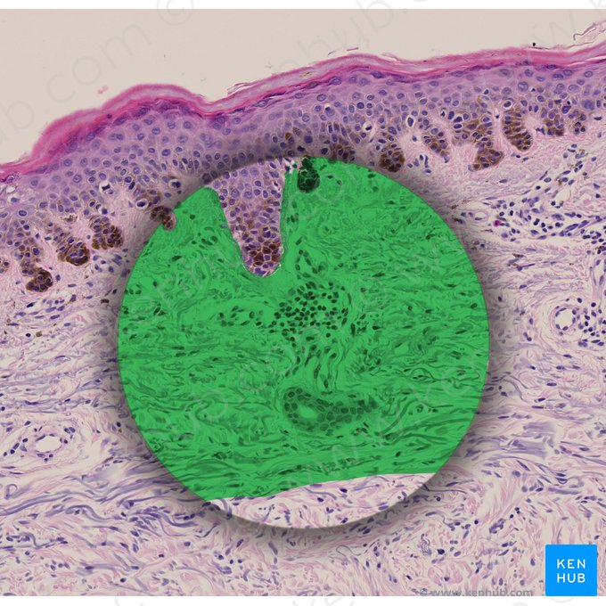 Tecido fibroconectivo; Imagem: 