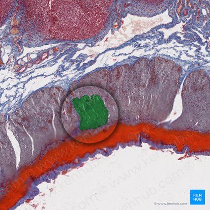 Stratum longitudinale externum tunicae muscularis (Äußere Längsmuskelschicht der Tunica muscularis); Bild: 