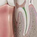 Canal radicular