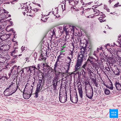 Célula enteroendócrina (Endocrinocytus gastrointestinalis); Imagen: 